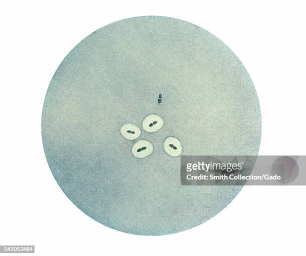 Photomicrograph of Streptococcus pneumoniae bacteria revealing capsular swelling using the Neufeld-Quellung test, 1979. This organism causes...