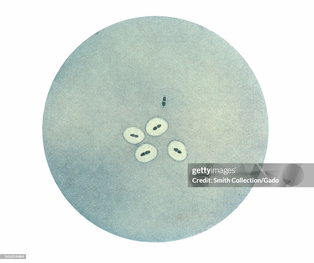 Streptococcus Pneumoniae