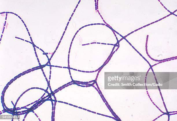 Photomicrograph demonstrating a positive Gram-stain with Bacillus anthracis, 1980. Anthrax is diagnosed by isolating B. Anthracis from the blood,...