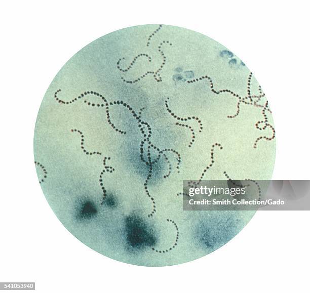This illustration depicts a photomicrographic view of Streptococcus pyogenes bacteria, 1979. In the last century, infections by Streptococcus...