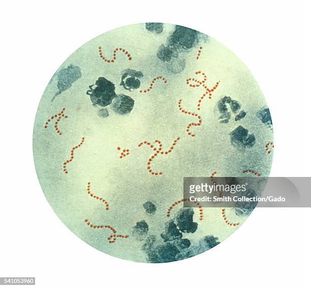 This illustration depicts a photomicrographic view of Streptococcus pyogenes bacteria at a magnification of 900X, 1979. A pus specimen, viewed using...