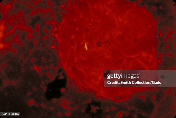 Mycobacterium Tuberculosis, News Photo