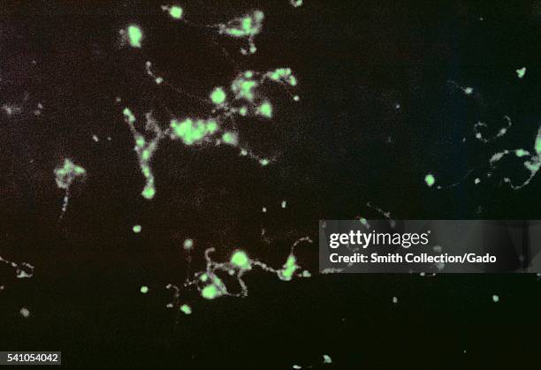 Photomicrograph of a Fluorescent Antibody stain of Leptospira bacteria in a liver impression smear, 1964. This specimen was from a patient who died...