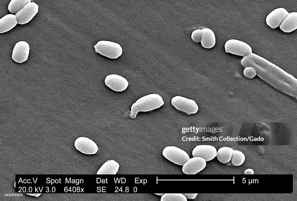 Bacillus Anthracis