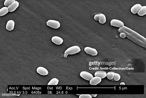 Under a magnification of 6,408X, this scanning electron micrograph depicted spores from the Aimes strain of Bacillus anthracis bacteria, 2002. A key...