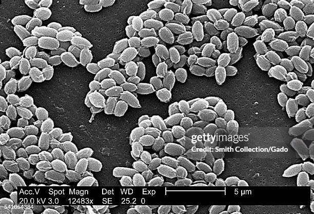 Under a high magnification of 12,483X, this scanning electron micrograph depicted spores from the Sterne strain of Bacillus anthracis bacteria, 2002....