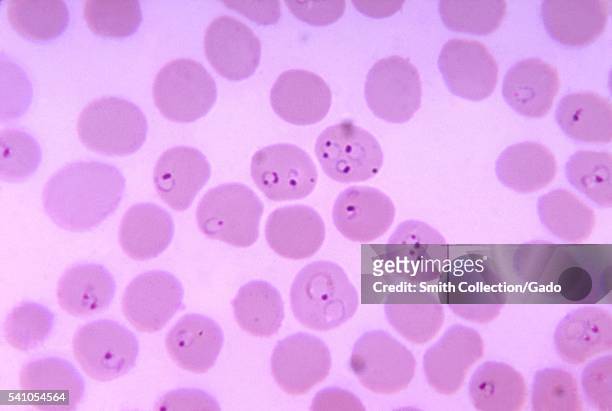 Photomicrograph of a blood smear showing Plasmodium falciparum rings inside erythrocytes, 1971. The term "ring" is derived from the morphologic...