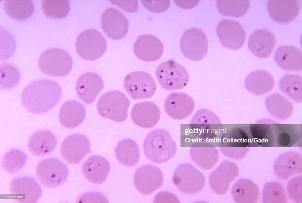 Plasmodium Falciparum