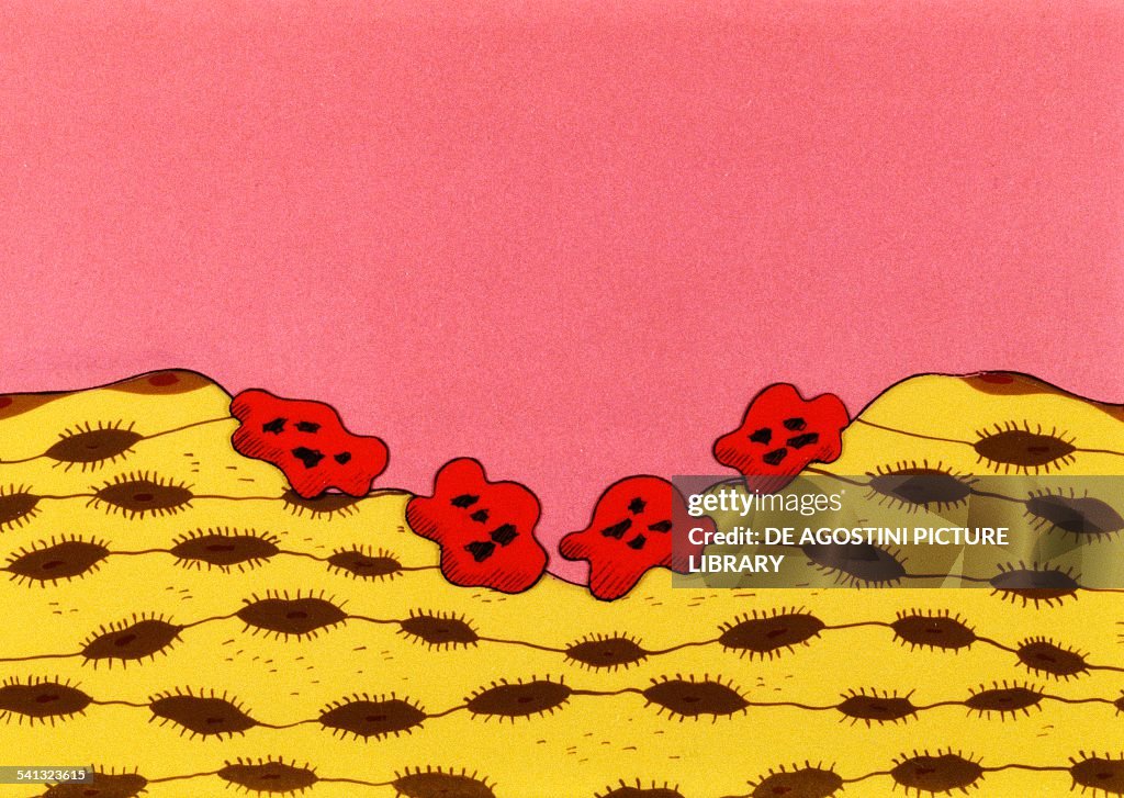 Osseous tissue, tissue demolition by osteoclasts...