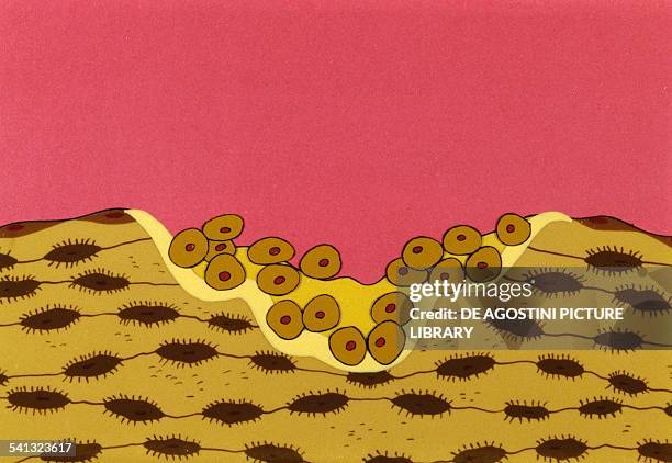 Osseous tissue, tissue reconstruction by osteoblasts, drawing. Step 1 of 2.