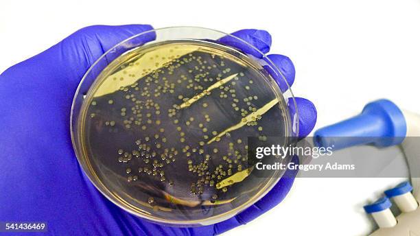 scientist's gloved hand holding a bacteria plate - agar jelly stock pictures, royalty-free photos & images