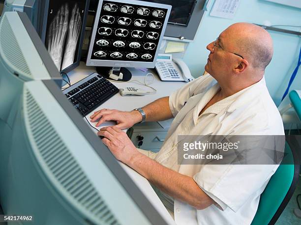 senior radiologist of oncology institute is examing mri scans - liver stockfoto's en -beelden