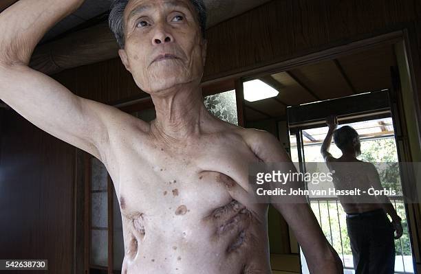 Due to thickened keloids on his back, Sumiteru Taniguchi still suffers from excruciating pains when he goes to bed. As a young man of 16, he was...