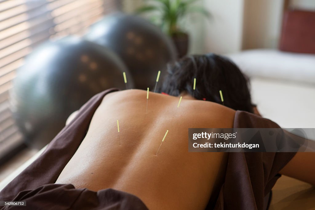 Japanese female get acupuncture treatment in kyoto japan