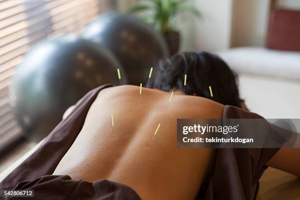 japonês feminino obtenha tratamentos de acupuntura de em quioto japão - acupuncture - fotografias e filmes do acervo