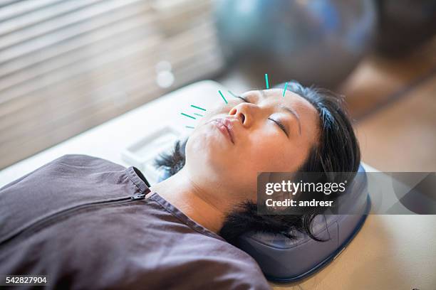 asian woman getting acupuncture - acupuncture stock pictures, royalty-free photos & images