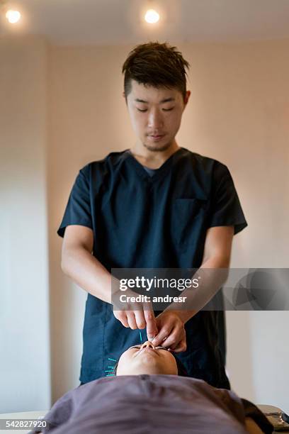 acupunturista colocando agulhas em uma mulher - acupuncture - fotografias e filmes do acervo