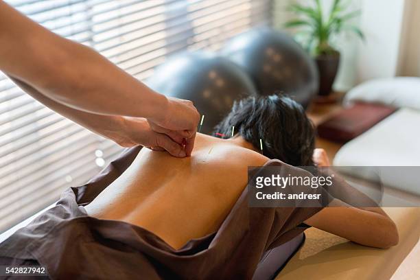 woman at the acupuncturist - alternative medicine stock pictures, royalty-free photos & images