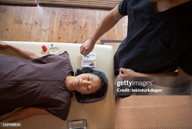 japanese female get acupuncture treatment in kyoto japan - acupuncture stockfoto's en -beelden