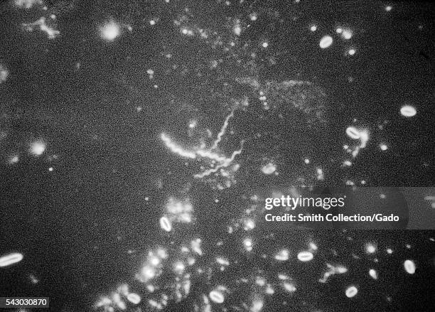 Treponema Rash Black Skin Rash Photos et images de collection - Getty Images