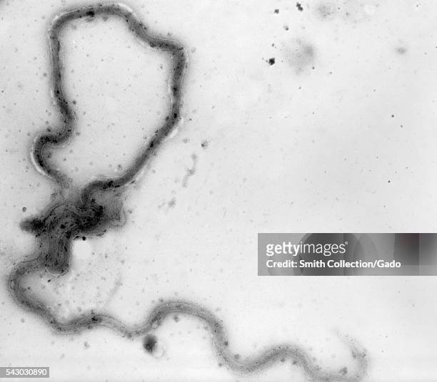 Photomicrograph of a Treponema pallidum bacterium. A photomicrograph of a whole mount of virulent T. Pallidum, 1970. This microscopic bacterium is a...