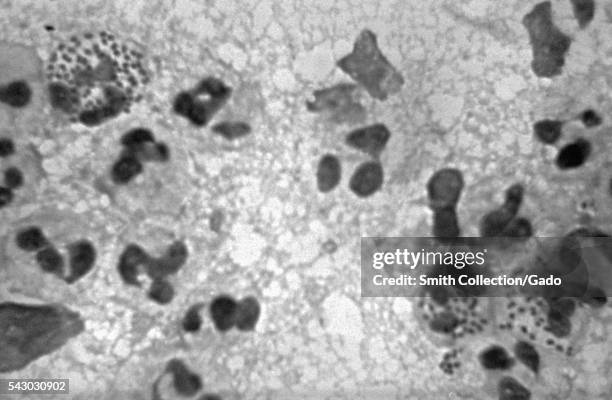 Photomicrograph of intracellular Neisseria gonorrhoeae bacteria, 1971. This photomicrograph shows the presence of gram-negative N. Gonorrhoeae...