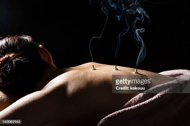 le donne mettono i carboni sulla schiena alla spa - agopuntura foto e immagini stock