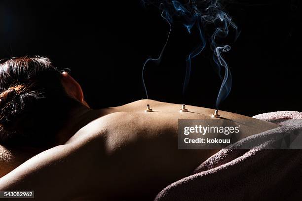 women put the coals on his back at the spa - acupuncture stock pictures, royalty-free photos & images