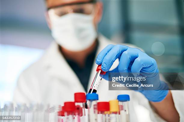 Medical Sample Collection Medical Sample Collection Fotografías e imágenes de stock - Getty Images