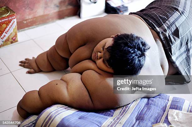 Arya Permana 10-year-old who weights 192 kilograms sleeping in his home on June 13, 2016 in West Java, Indonesia. A 10-YEAR-OLD from Indonesia has...