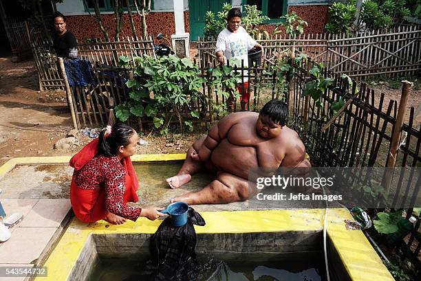 Arya Permana 10-year-old who weights 192 kilograms bath in a small pool in front home on June 13, 2016 in West Java, Indonesia. A 10-YEAR-OLD from...