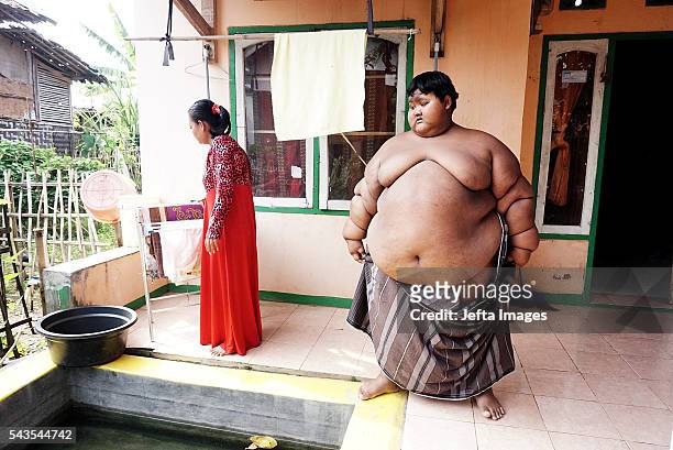 Arya Permana 10-year-old who weights 192 kilograms prepare for bath in a small pool in front home on June 13, 2016 in West Java, Indonesia. A...