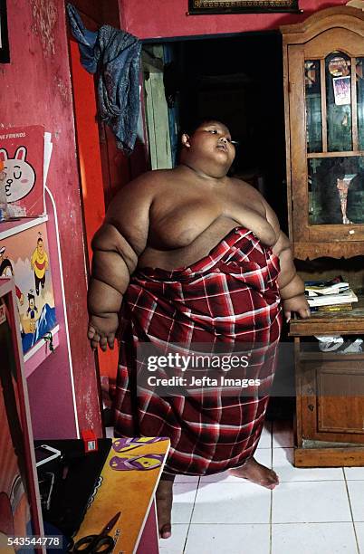 Arya Permana 10-year-old who weights 192 kilograms walk inside at his home on June 13, 2016 in West Java, Indonesia. A 10-YEAR-OLD from Indonesia has...