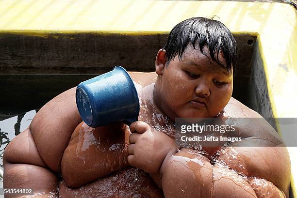 Arya Permana 10-year-old who weights 192 kilograms bath in a small pool in front home on June 13, 2016 in West Java, Indonesia. A 10-YEAR-OLD from...