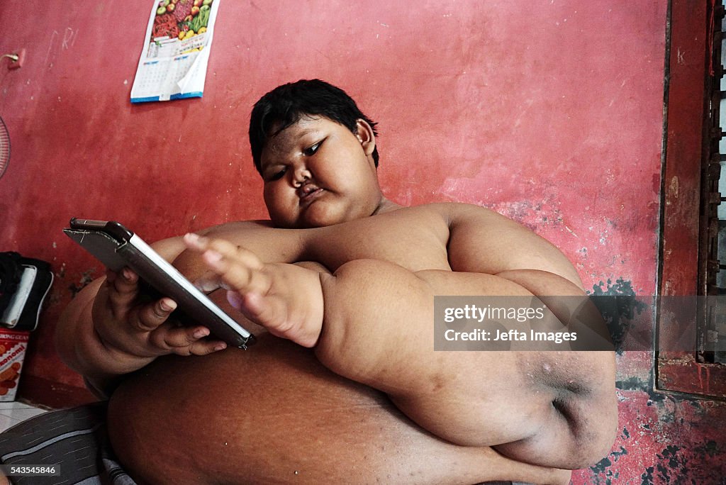 Family Fear For Morbidly Obese Boys Future
