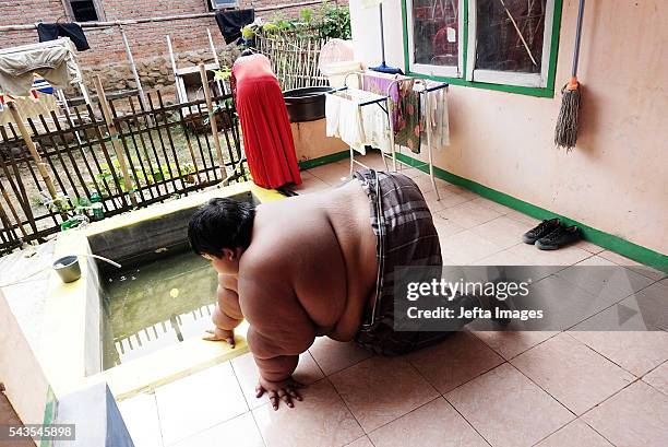 Arya Permana 10-year-old who weights 192 kilograms prepare for bath in a small pool in front home on June 13, 2016 in West Java, Indonesia. A...