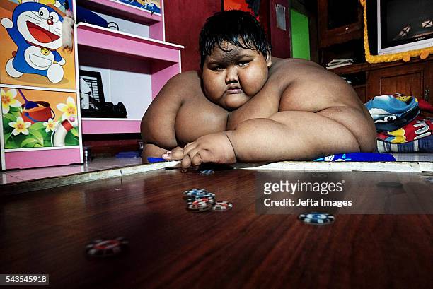 Arya Permana 10-year-old who weights 192 kilograms playing game with his friend in his home on June 13, 2016 in West Java, Indonesia. A 10-YEAR-OLD...