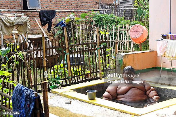 Arya Permana 10-year-old who weights 192 kilograms bath in a small pool in front home on June 13, 2016 in West Java, Indonesia. A 10-YEAR-OLD from...