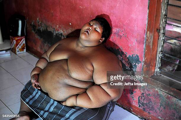 Arya Permana 10-year-old who weights 192 kilograms sleeping in his home on June 13, 2016 in West Java, Indonesia. A 10-YEAR-OLD from Indonesia has...