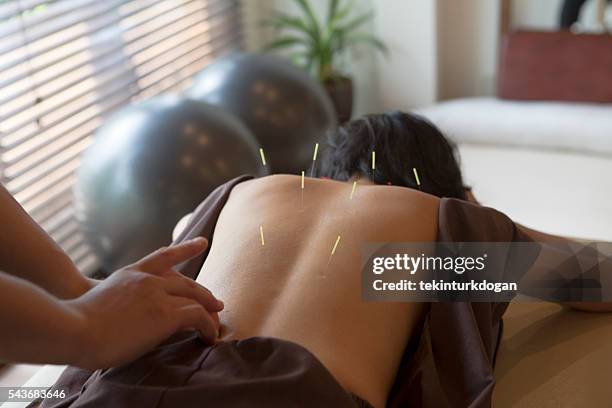 japanese female get acupuncture treatment in kyoto japan - accupuncture 個照片及圖片檔
