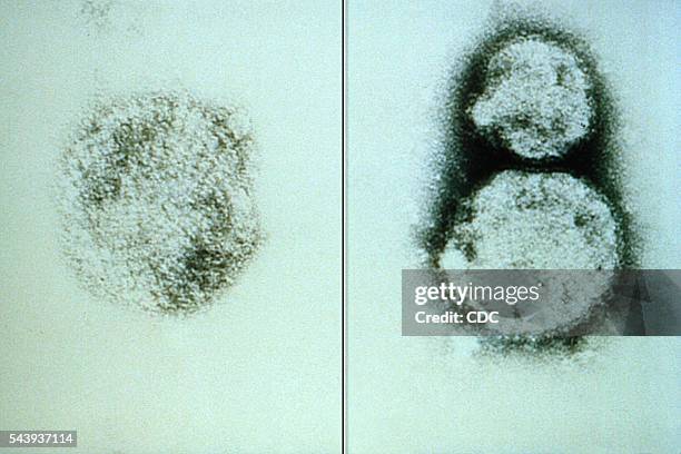 This electron micrograph depicts the hantavirus virions responsible for causing hantavirus pulmonary syndrome, or HPS. There is no specific...