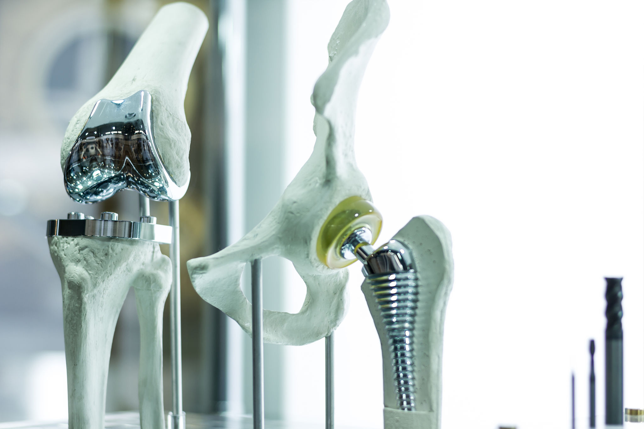 implant materials
