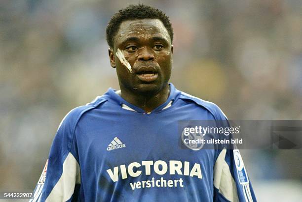 Gerald Asamoah Stuermer FC Schalke 04; D: traegt ein Pflaster auf der Wange