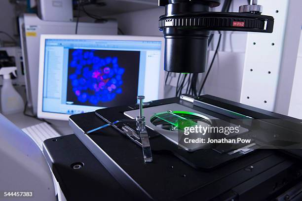cancer research laboratory, cells under electronic microscope - elektronenmicroscopisch-beeld stockfoto's en -beelden