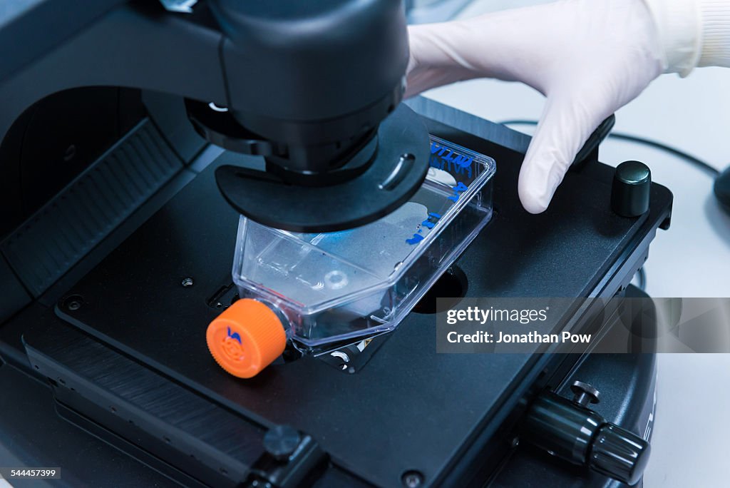 Cancer research laboratory, hand of scientist placing plastic cell bottle under microscope