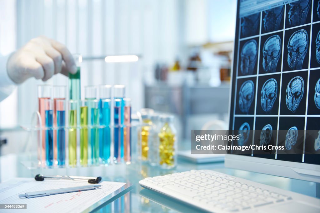 Hand reaching for vial with green fluid,monitor with x-rays in foreground