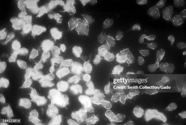 Photomicrograph of a positive indirect immunofluorescence test checking for the presence of Giardia lamblia, 1978. Giardia lamblia is the protozoan...