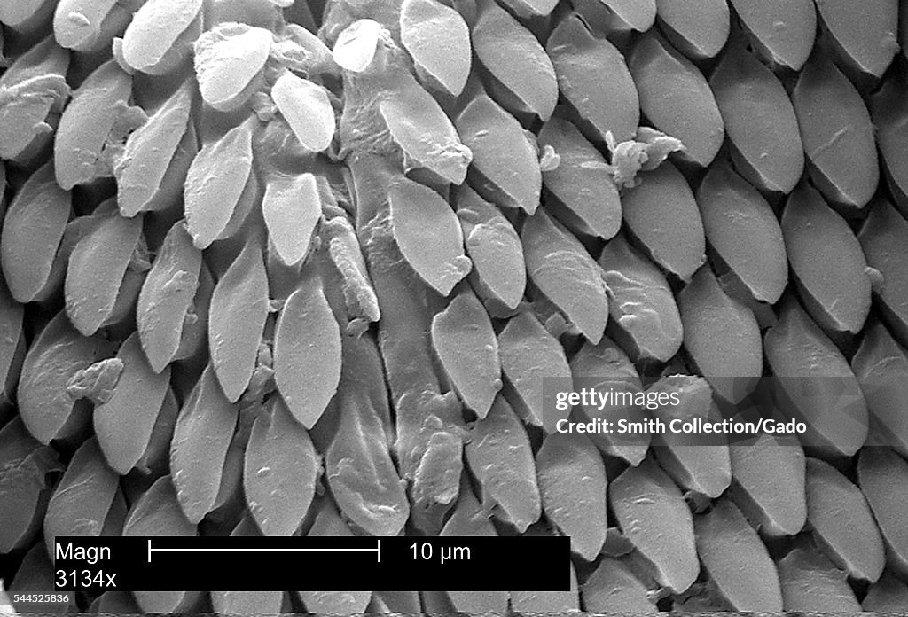 Dermacentor Variabilis