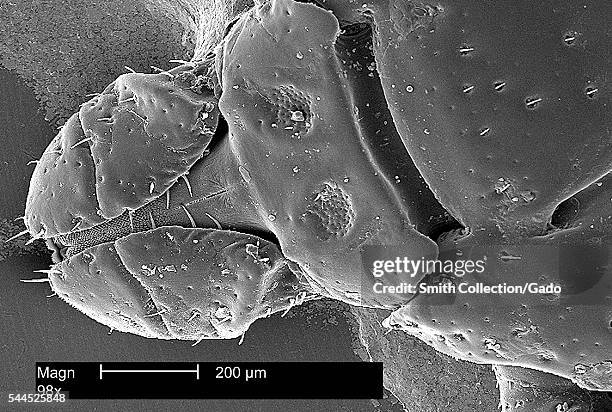 This scanning electron micrograph depicts the dorsal view of the head region from an American dog tick, Dermacentor variabilis, magnified 98X, 2002....