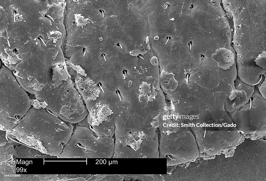 Dermacentor Variabilis